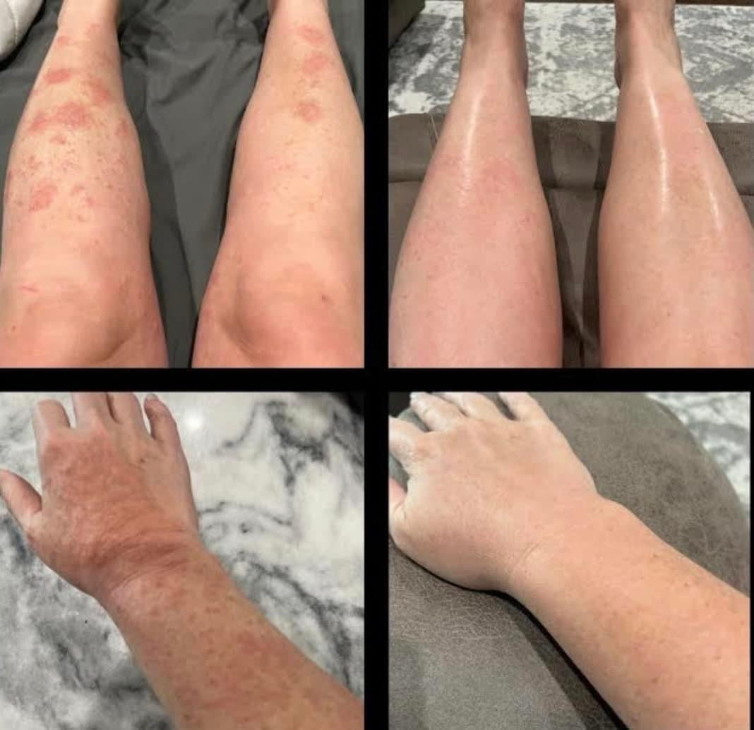 Honey Dew (Skin Calming Salve)